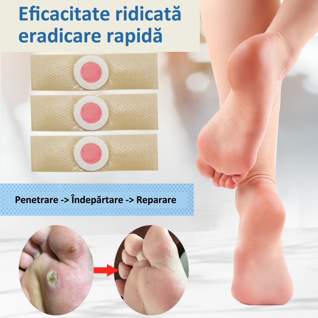 Plasturi Adezivi pentru Bătături și Calusuri | CaluFix